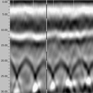 踏面表面から７０ｍｍの所に亀裂部分がある調査結果